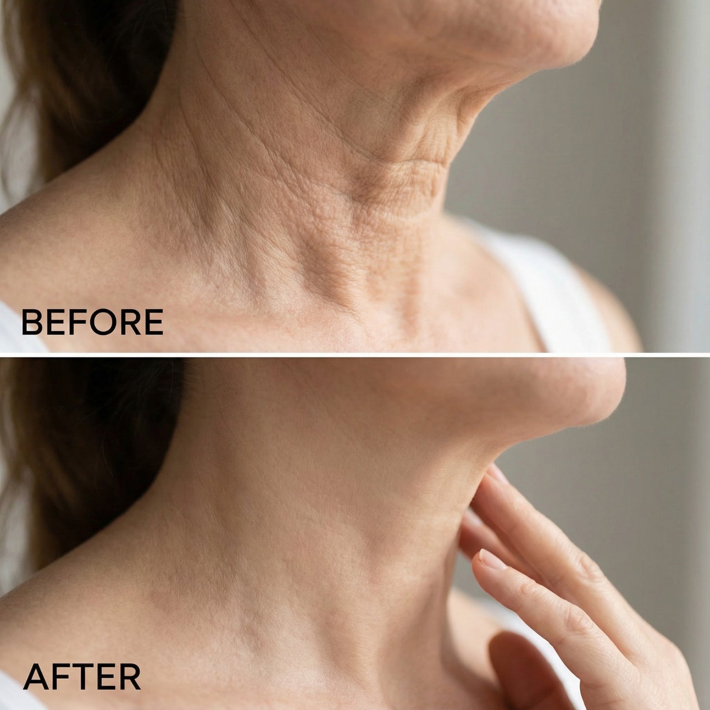 DermaLift™️ Wrinkle Patch