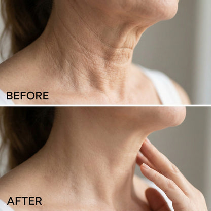 DermaLift™️ Wrinkle Patch