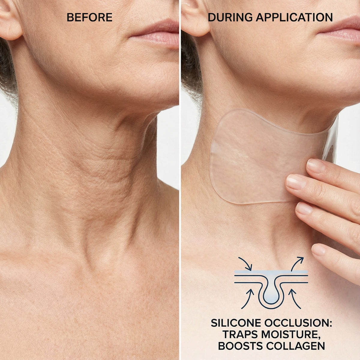 DermaLift™️ Wrinkle Patch